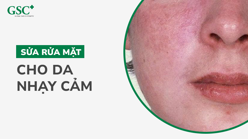 Sữa rửa mặt cho da nhạy cảm