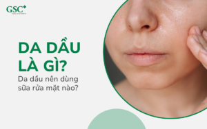 Da dầu là gì? Da dầu nên dùng sữa rửa mặt nào