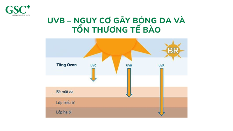 UVB – Nguy cơ gây bỏng da và tổn thương tế bào