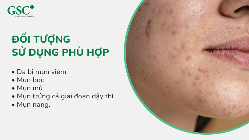 Đối tượng sử dụng phù hợp