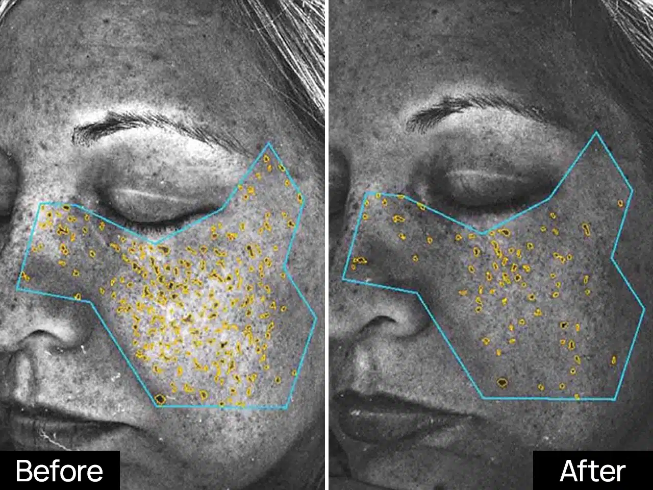 Mela Bright UV Defensive 1