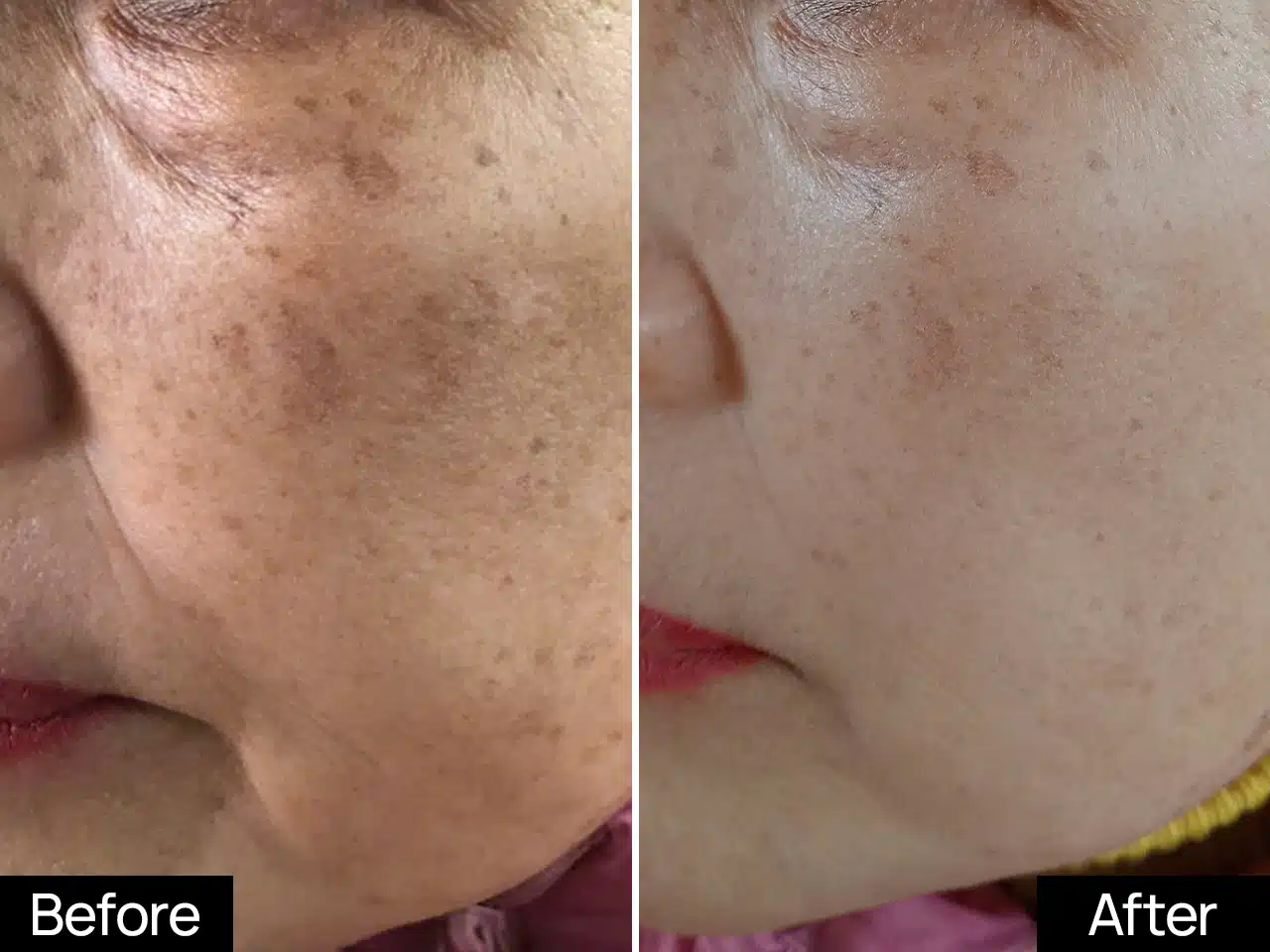 Mela Bright Spot Corrector 1